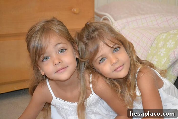 Inside the Story of the Worlds Most Gorgeous Twins 12 img 228228 11