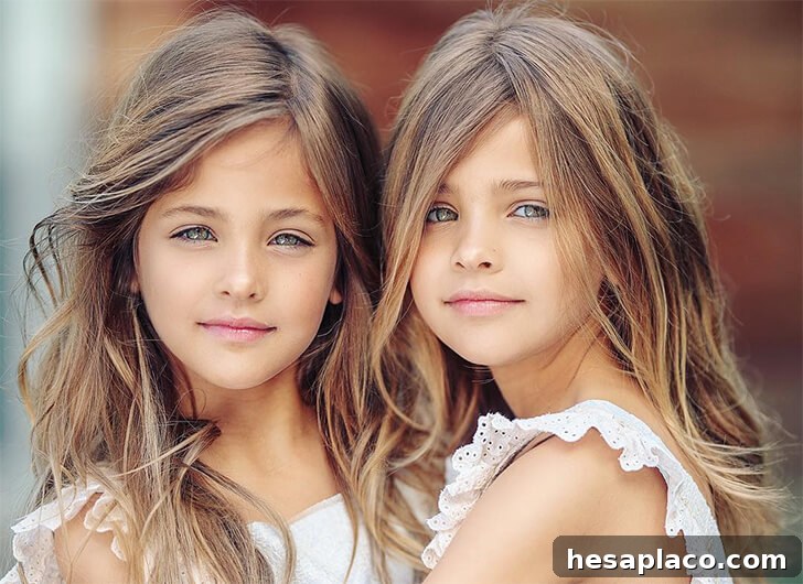 Inside the Story of the Worlds Most Gorgeous Twins 25 img 228228 24