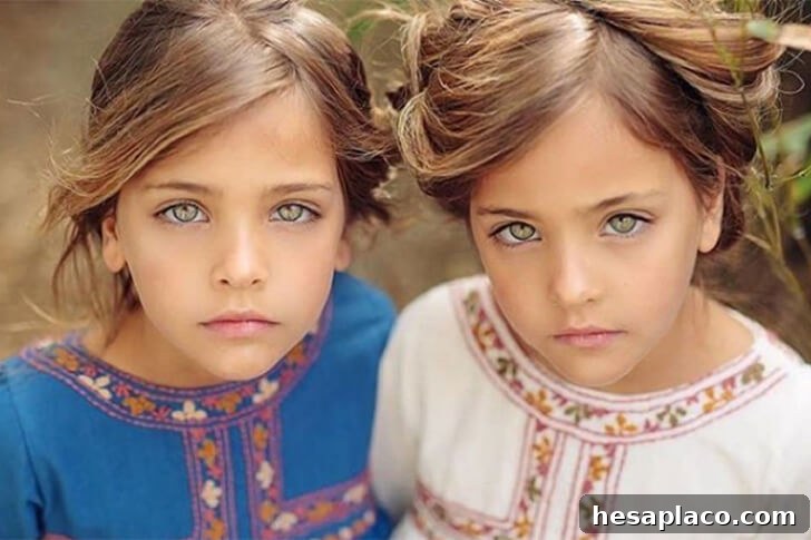 Inside the Story of the Worlds Most Gorgeous Twins 27 img 228228 26