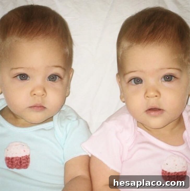 Inside the Story of the Worlds Most Gorgeous Twins 4 img 228228 3