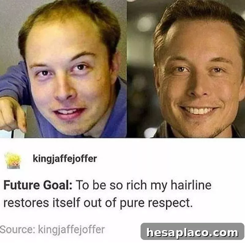 elon hair restoration